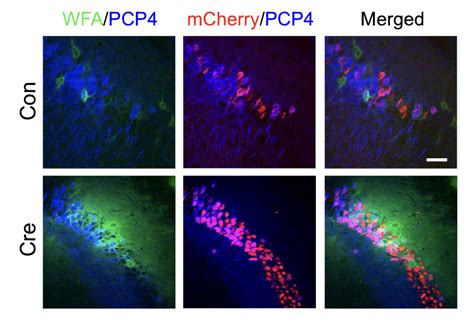 Neuroplasticity & CS - HSIEH-WILSON LAB