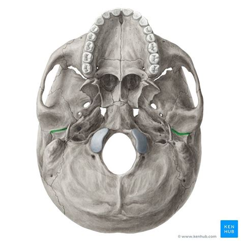 Petrotympanic fissure (Fissura petrotympanica); Image: Yousun Koh | Sphenoid bone, Palatine bone ...