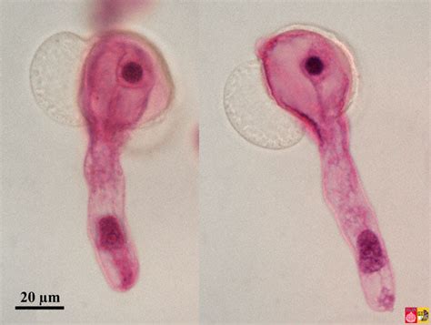 Pine Pollen Microscope