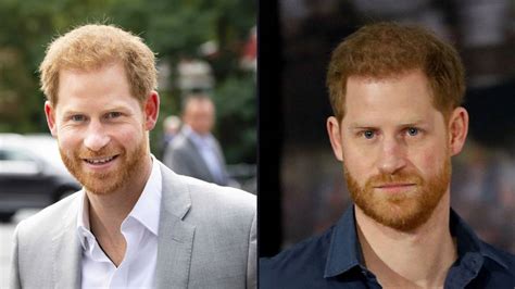 Hair transplant clinic credits Prince Harry for 100% rise in beard ...