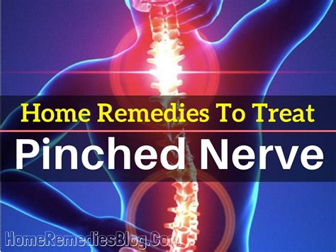 Top 12 Home Remedies To Treat Pinched Nerve in Neck, Back & Shoulder ...