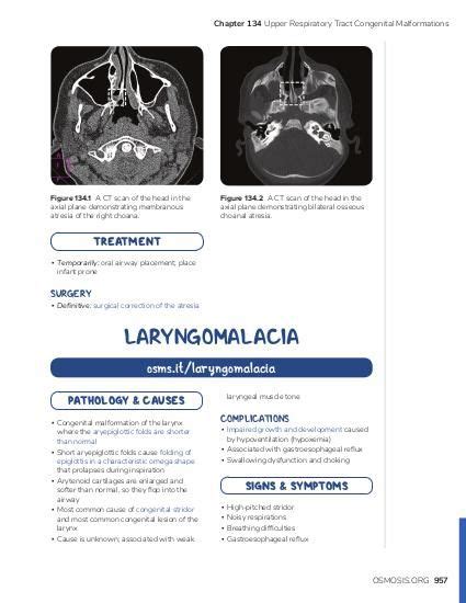 Choanal atresia: Video, Causes, & Meaning | Osmosis