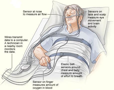 Sleep Apnea Diagnosis - Easmed