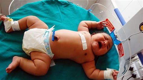 SBS Language | Indian mother gives birth to 'heaviest baby' recorded in history