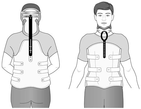 Using Your CTLSO (Spinal Brace) at Home | Treatments | Patients ...