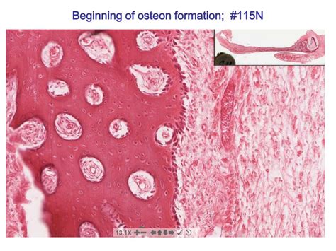 PPT - Bone Formation and Bone Remodeling PowerPoint Presentation, free ...