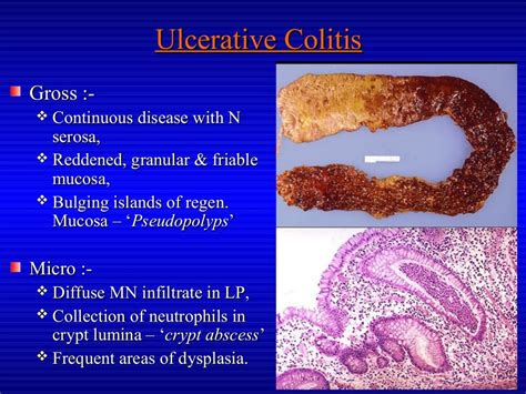 Premalignant lesions