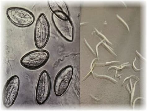 Infeksi Cacing Kremi Tanda Dan Gejala Penyebab Cara Mengobati Cara | My ...