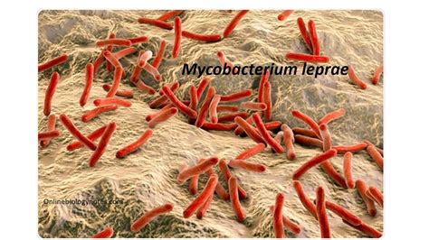 Mycobacterium leprae- general characteristics, habitat and virulence factors - Online Biology Notes