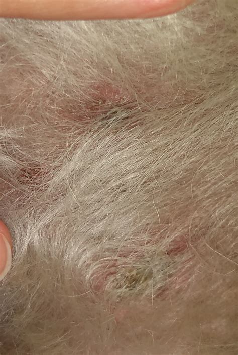 Odd scabby lesions keep showing up? | Dog Forum