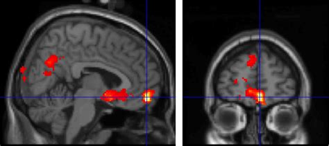 The Rejected Brain - The Anatomy Of Love