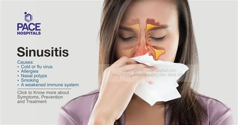 Sinusitis Symptoms Types Causes Treatment – NBKomputer