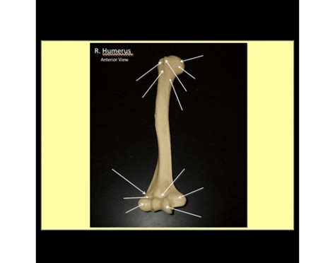 Upper Limb Bones 5 Quiz