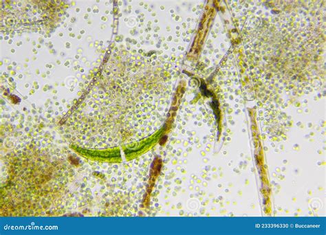 Microscopic View of Different Types of Algae Stock Photo - Image of ...