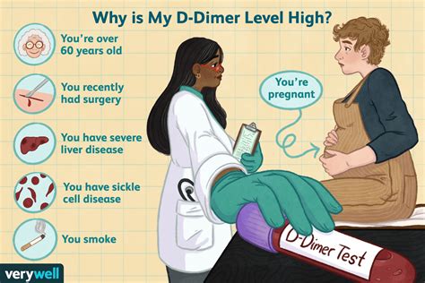 D-Dimer Test: What It Is, Testing, and Results