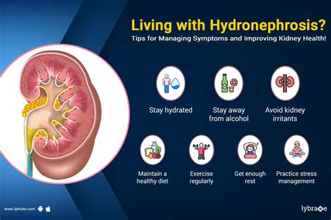 Hydronephrosis: Causes, Diagnosis, Treatment and Prevention - By Dr Tharun Bk | Lybrate