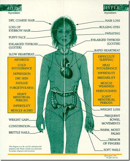 Disorders of thyroid - Medatrio