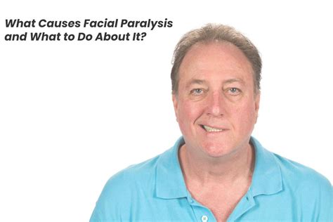 What Causes Facial Paralysis and What to Do About It? - 2021