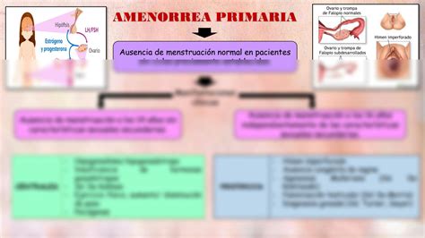 SOLUTION: Amenorrea primaria - Studypool