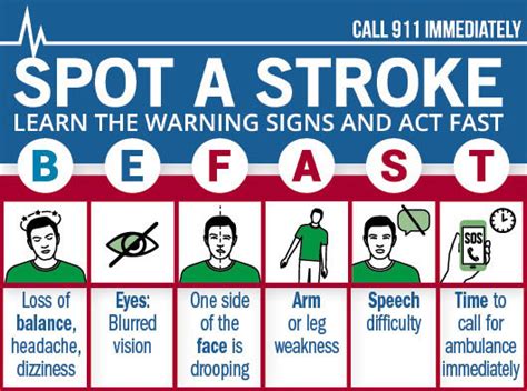 How to recognize and respond to a "warning" stroke - Harvard Health