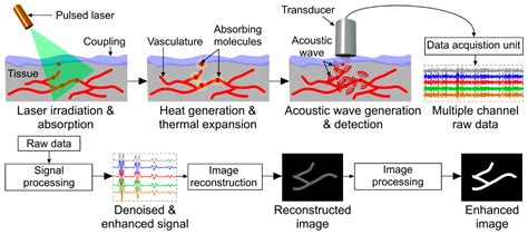 Optics | Free Full-Text | Signal and Image Processing in Biomedical ...