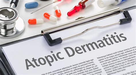 FDA Approves New Sub-Q Tx for Atopic Dermatitis - Adbry - Anton Health