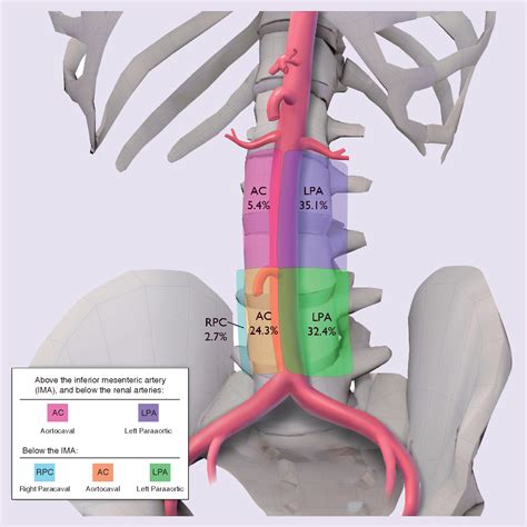 Para Aortic Lymph Nodes