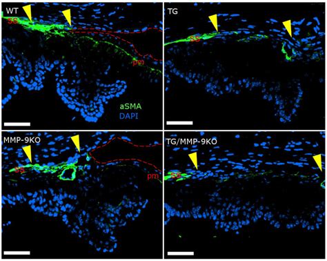 Immunolocalization of alpha smooth muscle actin in anterior chamber ...