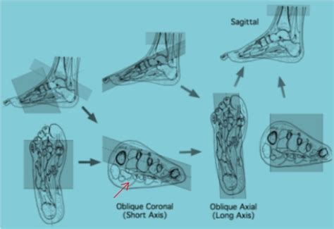 The MRI Technologist Role in Foot/Ankle Positioning | All-American Teleradiology