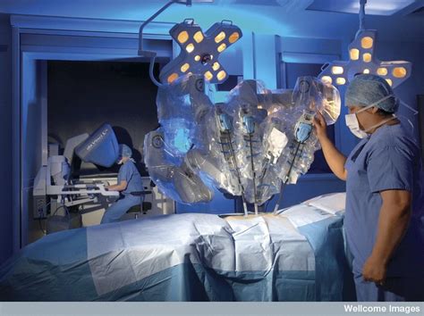 Robot Surgery - the da Vinci Robot - Science Museum Blog