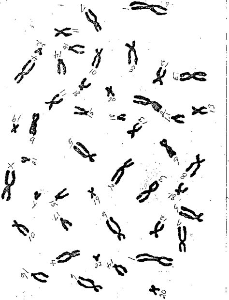 karyotype lab