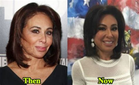 Jeanine Pirro facelift before and after - Latest Plastic Surgery Gossip ...