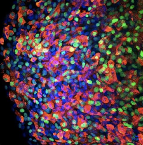 Type 1 diabetes from a beta cell's perspective - MIT Department of Biology