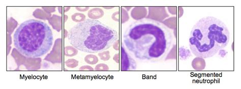 Canine left shift | eClinpath