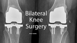 Bilateral Knee Replacement Surgery - X10 Therapy