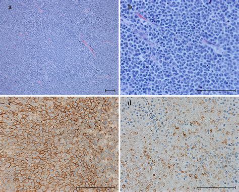 Histological findings in the uterine cervix. a, b A prevalent solid ...