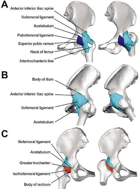 Lateral Aspect Of The Hip