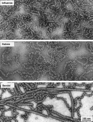 Paramyxoviridae | Basicmedical Key