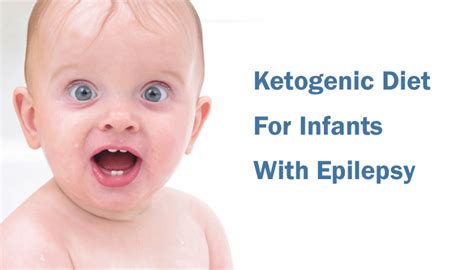 Better seizure control with ketogenic diet in infants with genetic ...