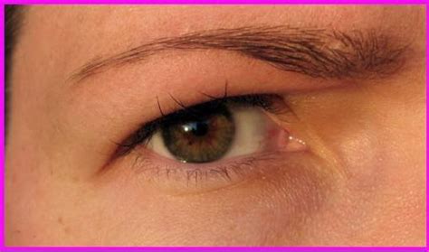 Itchy eyebrows - symptoms & treatments