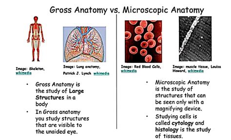 [Solved] What are your thoughts on gross anatomy compared to ...