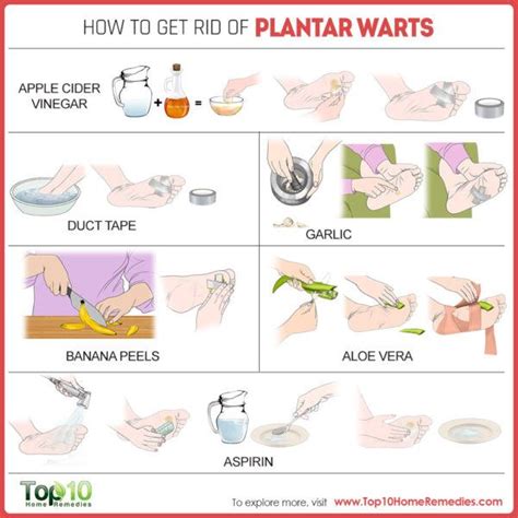 How to Get Rid of Plantar Warts | Top 10 Home Remedies