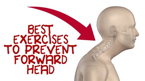 Forward Head Posture Exercises Correcting