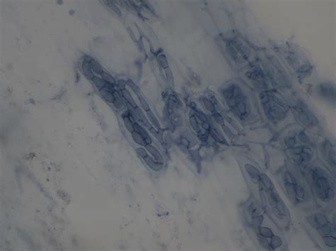 104 questions with answers in ARBUSCULAR MYCORRHIZA | Science topic