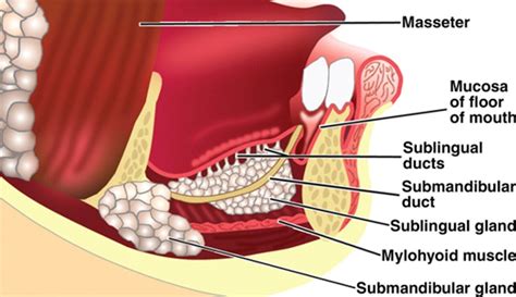 Excision of Sublingual Gland | Pocket Dentistry