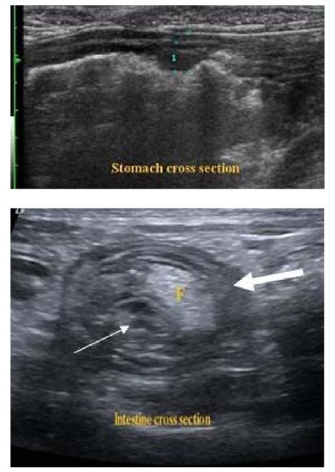 Ultrasound cross scan of stomach wall in a 12 years old dog: a focal ...