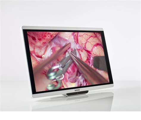 4K surgical display – International Hospital