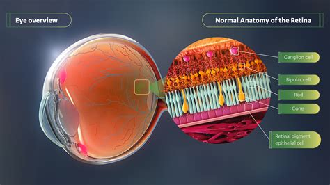 Late-Breaking 12-Month Data of RPGR Gene Therapy Shows Statistically ...