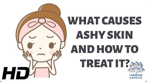 WHAT CAUSES ASHY SKIN AND HOW TO TREAT IT - YouTube