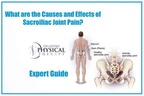 Causes and Effects of Sacroiliac Joint Pain? Expert Guide – Oklahoma Physical Therapy